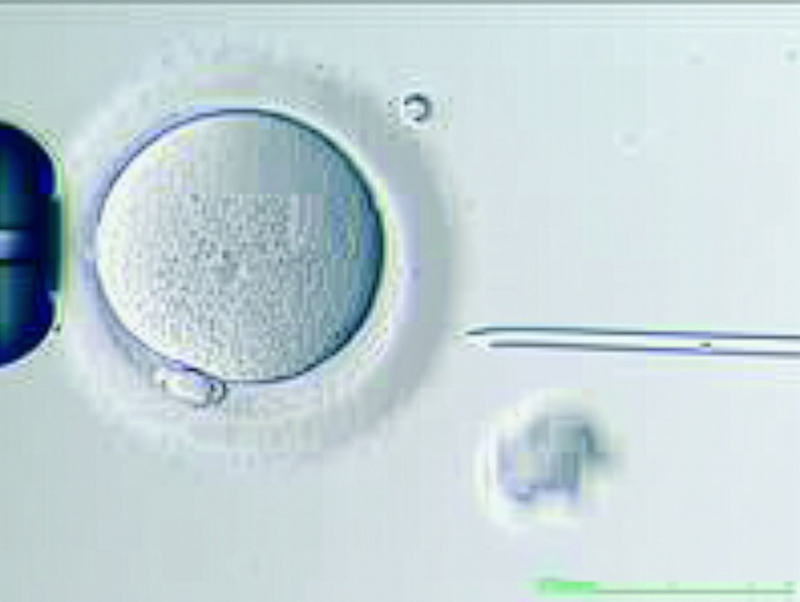 Spermieninjektion Eizelle