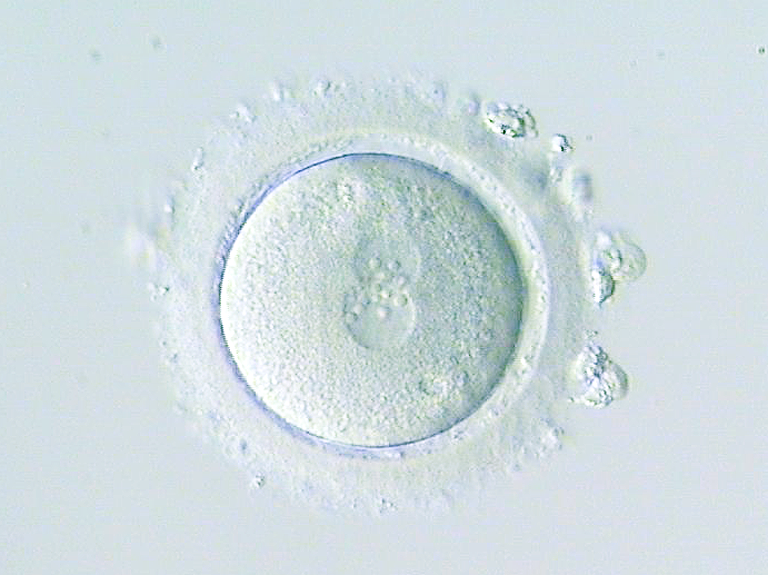 IVF Langes Protokoll